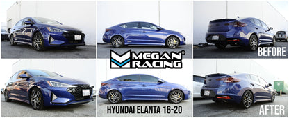 Megan Racing Coilovers Rear for Hyundai Elantra Sport 2016-2020 - 32-Level Adjust, Camber Adjustable Pillowball Front Top Mounts MR-CDK-HYE16S